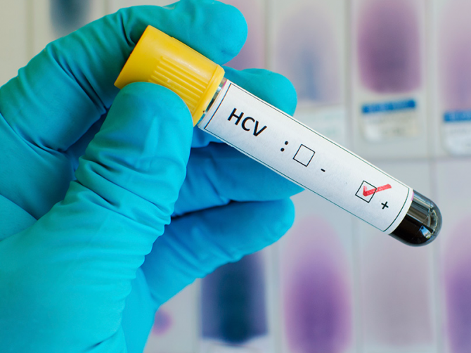 Анализ крови на гепатит как сдавать натощак или нет thumbnail