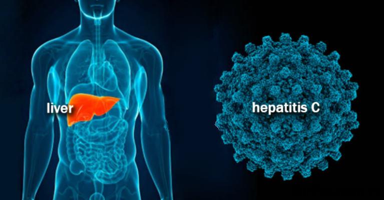 способы лечения гепатита С