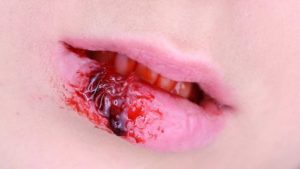 Поцелуи и гепатит С: насколько высок риск заразиться вирусом через слюну, Профилактика заражения