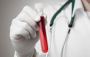 Как сдавать кровь на гепатит С – натощак или нет: правильная подготовка к сдаче анализа крови на гепатит С, Диагностика Гепатита С