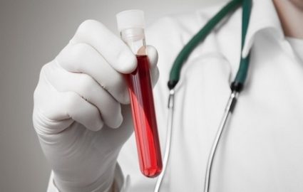 Как сдавать кровь на гепатит С