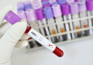 Как скоро после заражения вирусным гепатитом В можно обнаружить его в анализах, Обзор и факты