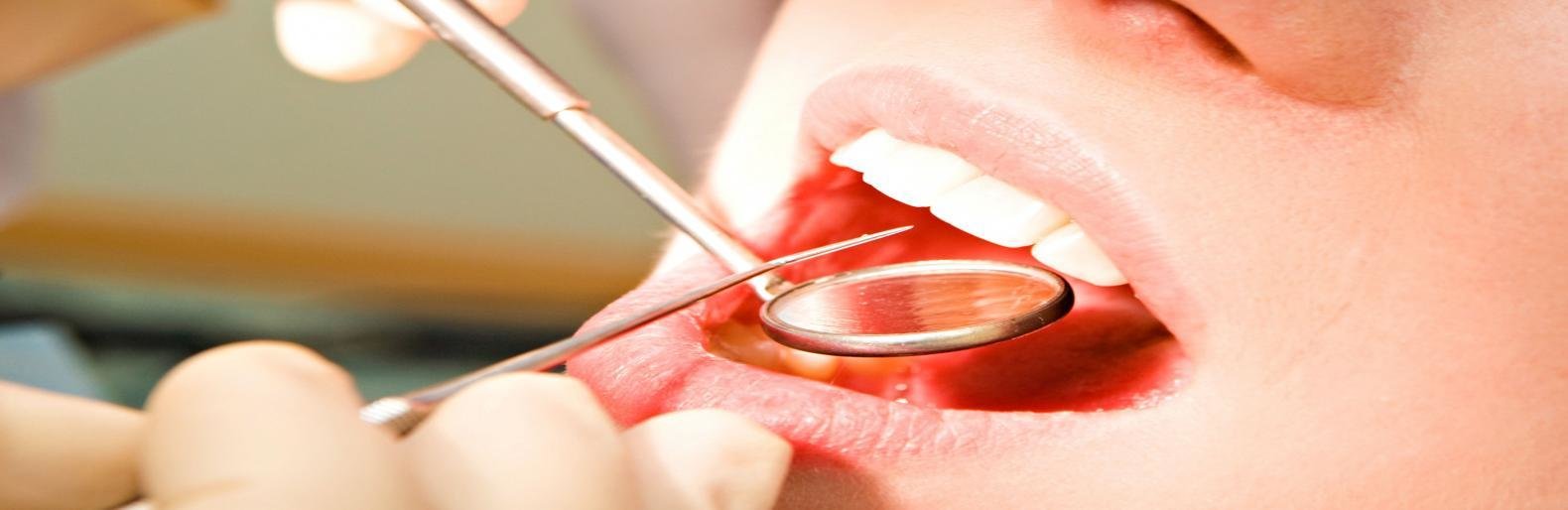 стоматолог при гепатите